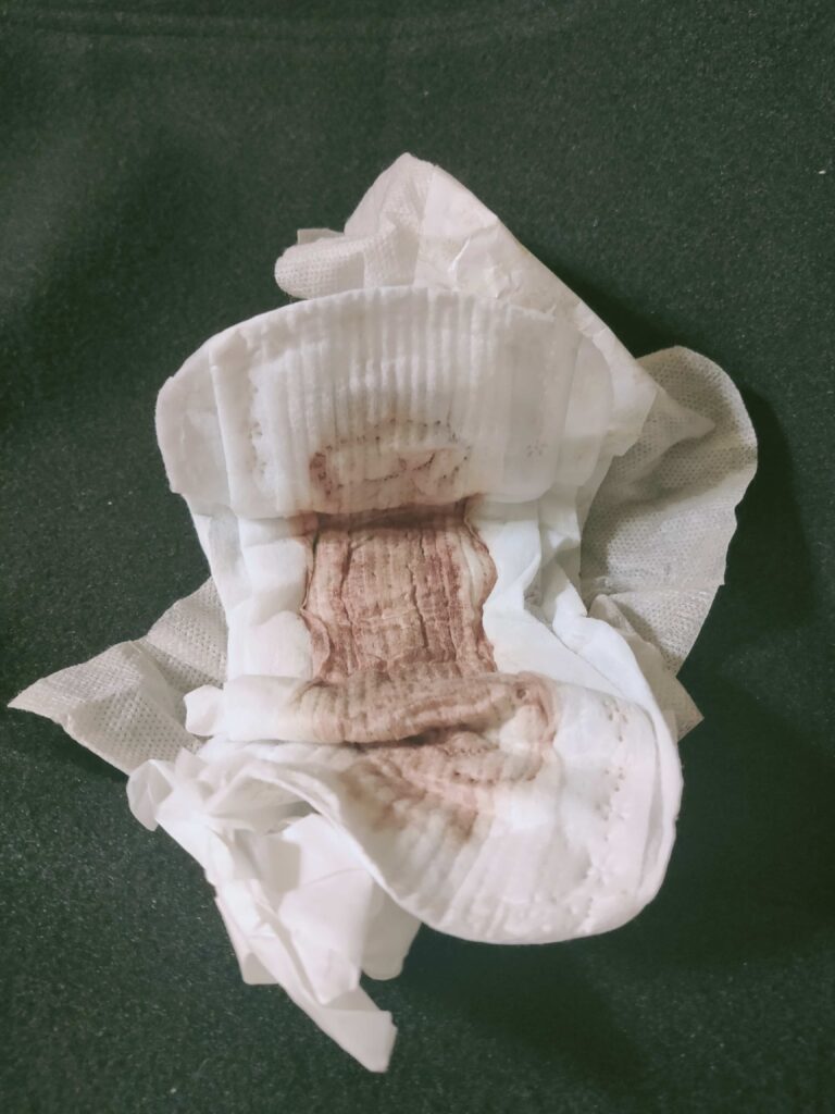 生理の経血を吸収したパット